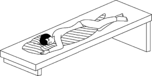 体位ドレナージ