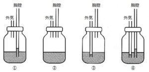 ドレナージ 